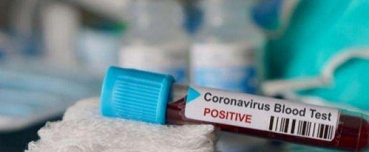Salah Menilai Risiko Virus Corona di Wuhan, WHO Minta Maaf